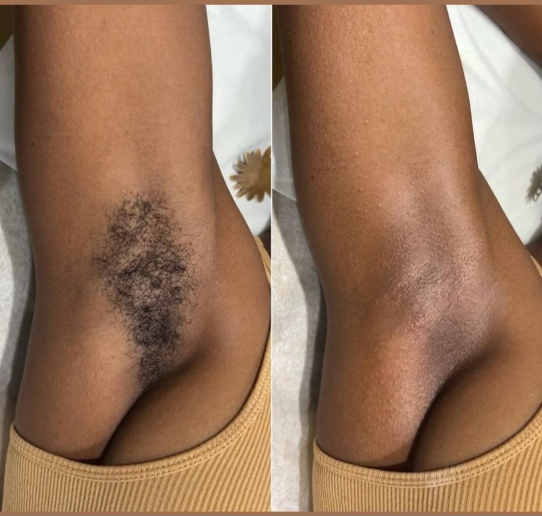 Before and After Waxing 3