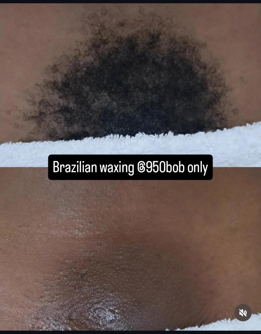 Intimate skincare treatments for women